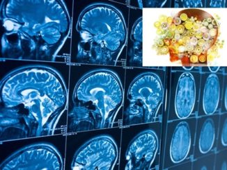 Ospedale, prestigiosa indagine nazionale neuroriabilitazione a Foligno