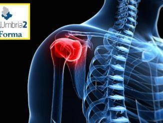 Patologie della spalla, primo intervento Bone-Block in Umbria, a Foligno