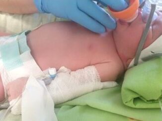 Ospedale di Foligno, dimessa in buone condizioni la neonata prematura di 34 settimane